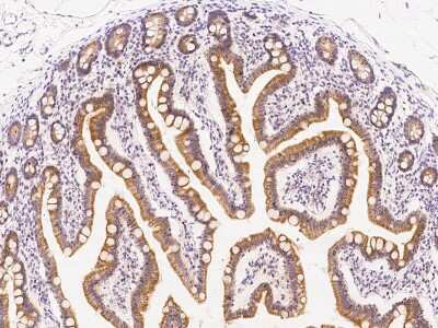 Immunohistochemistry-Paraffin: AADAC Antibody [NBP2-99385]