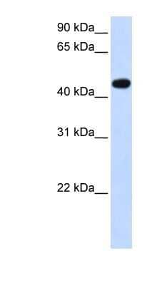 Western Blot: AADAC Antibody [NBP1-62428]