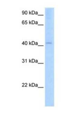 Western Blot: AADAC Antibody [NBP1-69445]