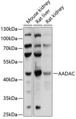 Western Blot: AADAC AntibodyBSA Free [NBP2-92619]