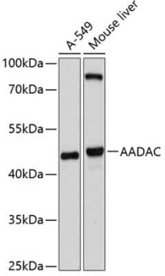 Western Blot: AADAC AntibodyBSA Free [NBP2-92698]