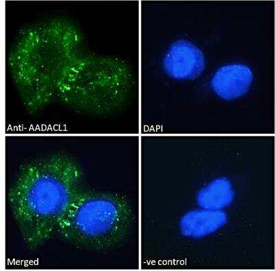 Immunofluorescence: AADACL1 Antibody [NBP2-76805]