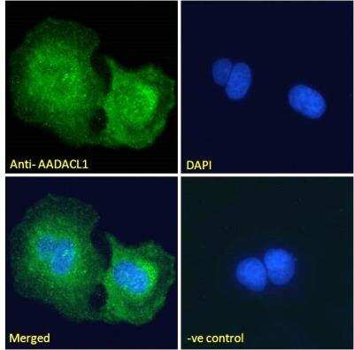 Immunofluorescence: AADACL1 Antibody [NBP2-76805]