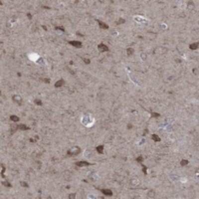 Immunohistochemistry-Paraffin: AADACL1 Antibody [NBP3-17795]