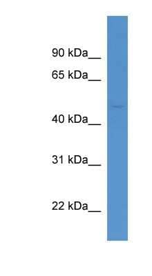 Western Blot: AADACL1 Antibody [NBP1-79318]