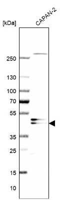 Western Blot: AADACL1 Antibody [NBP1-90294]