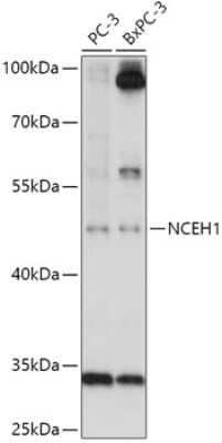 Western Blot: AADACL1 AntibodyAzide and BSA Free [NBP2-92379]