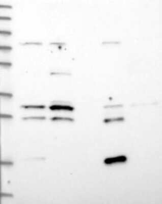 Western Blot: AADACL1 Antibody [NBP3-17795]