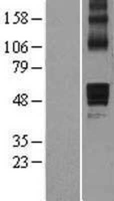 Western Blot: AADACL1 Overexpression Lysate [NBL1-07162]