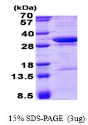 SDS-PAGE: Recombinant Human AADACL1 His Protein [NBP2-23283]