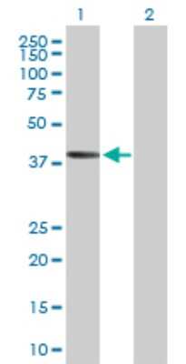 Western Blot: AADACL2 Antibody [H00344752-B01P]