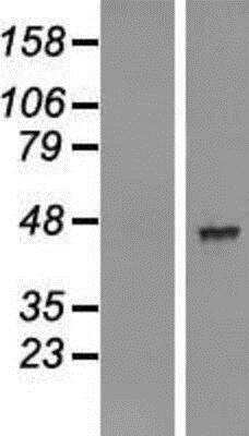 Western Blot: AADACL2 Overexpression Lysate [NBL1-07163]