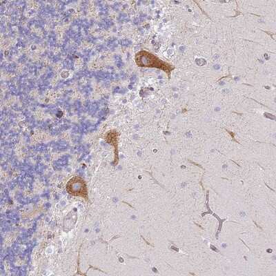 Immunohistochemistry-Paraffin: AADACL4 Antibody [NBP2-14248]