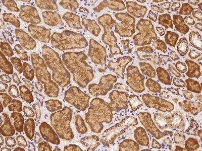 Immunohistochemistry-Paraffin: AADACL4 Antibody [NBP3-06223]