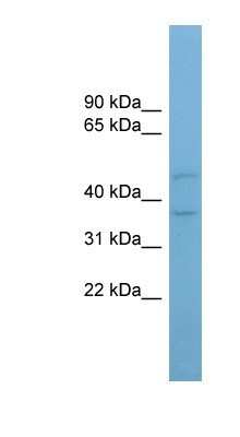 Western Blot: AADACL4 Antibody [NBP1-91584]