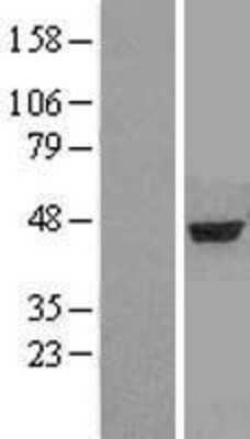 Western Blot: alpha-Aminoadipate Aminotransferase Overexpression Lysate [NBP2-04829]