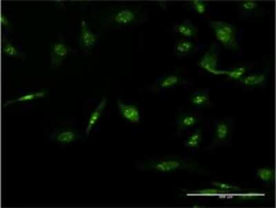 Immunocytochemistry/ Immunofluorescence: AAK1 Antibody (4B10) [H00022848-M02]