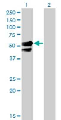 Western Blot: AAK1 Antibody (4B10) [H00022848-M02]