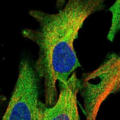 Immunocytochemistry/ Immunofluorescence: AAK1 Antibody [NBP1-84111]