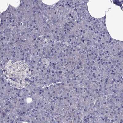 Immunohistochemistry-Paraffin: AAK1 Antibody [NBP1-84110]