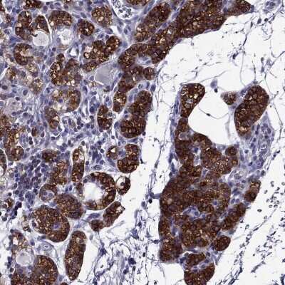 Immunohistochemistry-Paraffin: AAK1 Antibody [NBP1-84110]