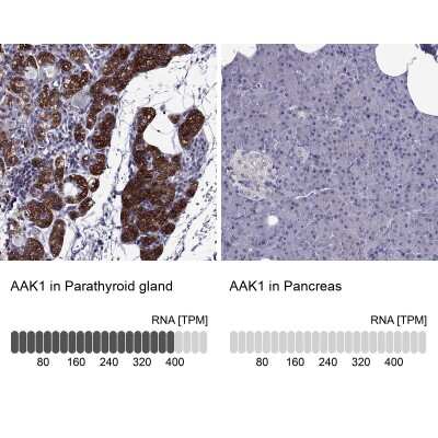 Immunohistochemistry-Paraffin: AAK1 Antibody [NBP1-84110]