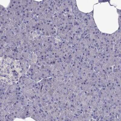 Immunohistochemistry-Paraffin: AAK1 Antibody [NBP1-84111]