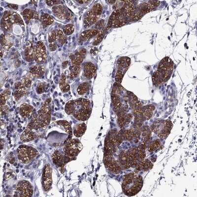 Immunohistochemistry-Paraffin: AAK1 Antibody [NBP1-84111]