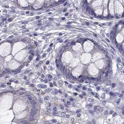 Immunohistochemistry-Paraffin: AAK1 Antibody [NBP1-84111]