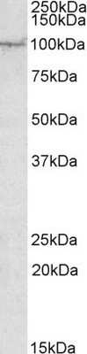 Western Blot: AAK1 Antibody [NBP1-45214]