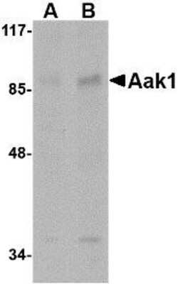 Western Blot: AAK1 AntibodyBSA Free [NBP1-76343]