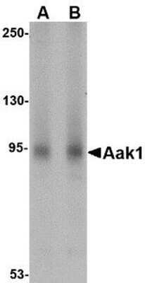 Western Blot: AAK1 AntibodyBSA Free [NBP1-77335]