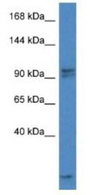 Western Blot: AAK1 Antibody [NBP1-79574]