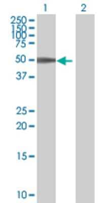 Western Blot: AAK1 293T Cell Transient Overexpression Lysate [H00022848-T01]