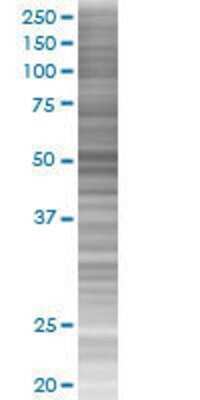 Western Blot: AAK1 293T Cell Transient Overexpression Lysate [H00022848-T01]