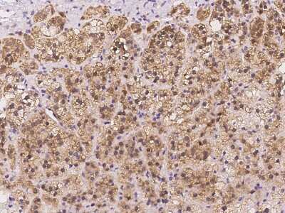 Immunohistochemistry-Paraffin: AAMDC Antibody [NBP2-97175]