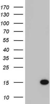 Western Blot: AAMDC Antibody (OTI1C4)Azide and BSA Free [NBP2-71840]