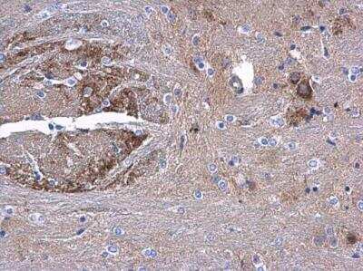 Immunohistochemistry-Paraffin: AAMP Antibody [NBP2-21597]