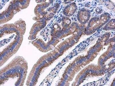 Immunohistochemistry-Paraffin: AAMP Antibody [NBP2-21597]