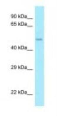 Western Blot: AAMP Antibody [NBP1-98514]