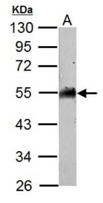 Western Blot: AAMP Antibody [NBP2-21597]