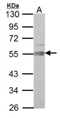 Western Blot: AAMP Antibody [NBP2-21597]