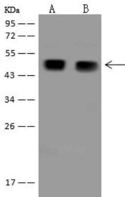 Western Blot: AAMP Antibody [NBP3-12703]