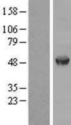 Western Blot: AAMP Overexpression Lysate [NBP2-08441]