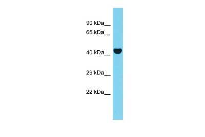 Western Blot: AAR2 Antibody [NBP2-82543]