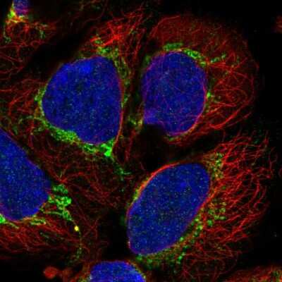 Immunocytochemistry/ Immunofluorescence: AARS2 Antibody [NBP2-55710]