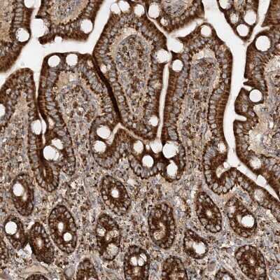 Immunohistochemistry-Paraffin: AARS2 Antibody [NBP1-89323]