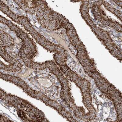 Immunohistochemistry-Paraffin: AARS2 Antibody [NBP1-89323]