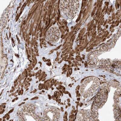 Immunohistochemistry-Paraffin: AARS2 Antibody [NBP1-89323]