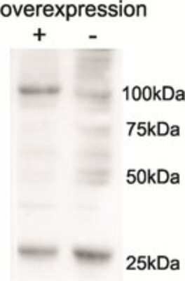 Western Blot: AARS2 Antibody [NBP2-26119]